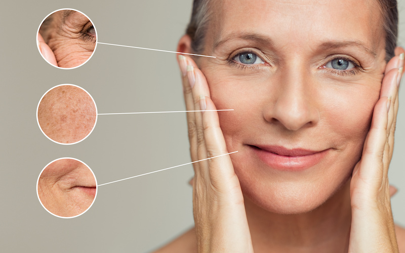 The Most Common Issues of SKIN Aging