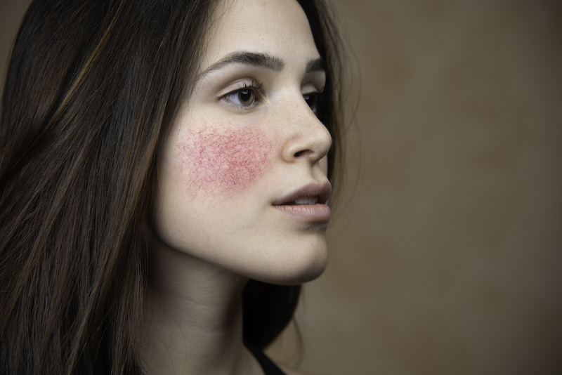 9 Signs of Sensitive Skin